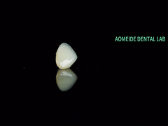 세라믹 크라운 브리지