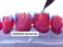 강도 자연적 미학 고형 지르코니아 왕관 단 1개 또는 여러 개의 치아에 적합