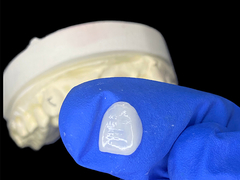 IPS e.max A1 색조의 절개구리 장단