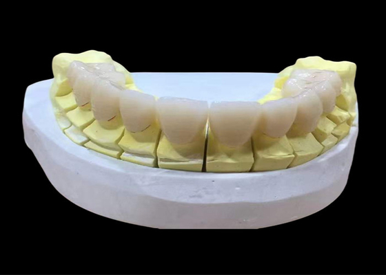 주문 지르코니아 포르셀라인 치과 왕관 online manufacture