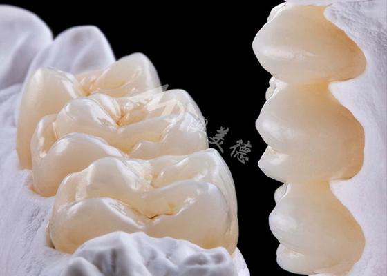 주문 고강도 Zirconia 치아 왕관 단일 또는 여러 치아를 교체하기 위해 online manufacture