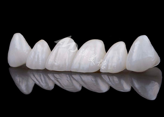 주문 자연스러운 외모 Zirconia 치아 왕관 얼룩 저항 모든 Zirconia 왕관 online manufacture