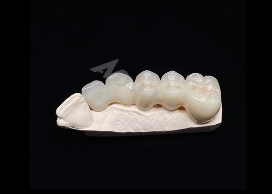 주문 반투명성 자연 미학 고체 지르코니아 왕관 치아 찢어질 수 없는 online manufacture