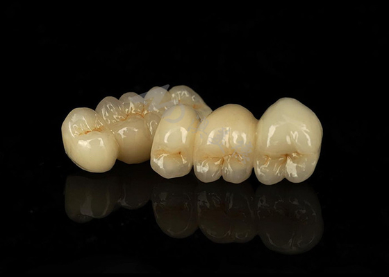 주문 얼룩에 저항하는 고체 지르코니아 크라운 online manufacture