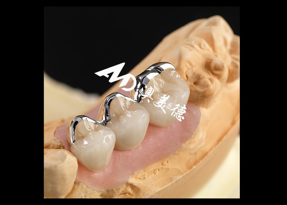 주문 강성 PFM 포르셀라인이 금속 왕관에 합성되었습니다 online manufacture