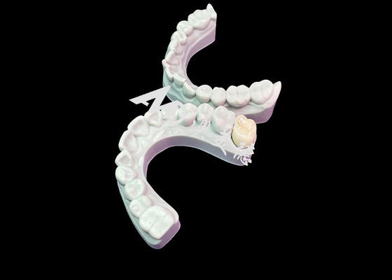 주문 정밀 맞춤 Zirconia 치아 왕관 미적 자연 색상 우수한 생물 호환성 online manufacture