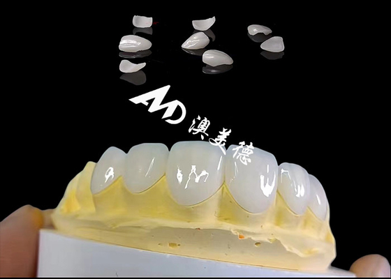 주문 투명성 IPS 에맥스 포니어, 최소 준비 online manufacture