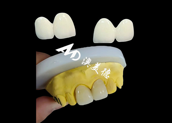 주문 중국 치과 연구소에서 주문 지르코니아 치과 왕관 정밀 맞춤 치과 모자 online manufacture