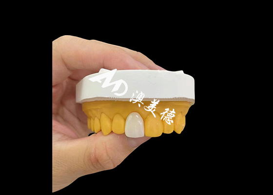 주문 앞 절개구 Zirconia 치아 왕관 자연스러운 외모 고강성 착용 저항성 online manufacture