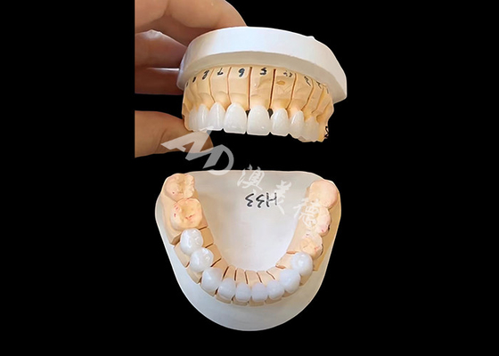 주문 증강 투명성 Zirconia 치아 왕관 단일 / 멀티 유닛 고정 복원 online manufacture