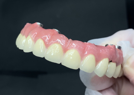 주문 청결 하기 쉬운 티타늄 기단 과 지르코니아 왕관 을 가진 내구성 있는 치아 임플란트 online manufacture