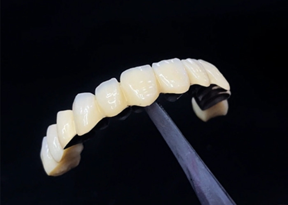 주문 금속 왕관 에 녹인 진주 로 치아 건강 을 위해 내구성 과 아름다움 을 결합 한다 online manufacture