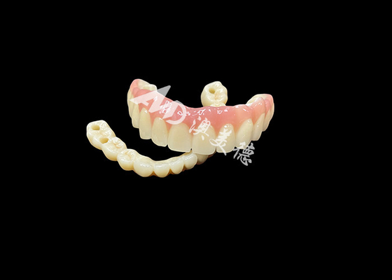 주문 임플란트 지원 치아 교대 결실 치아에 대한 궁극적인 치아 해결책 online manufacture