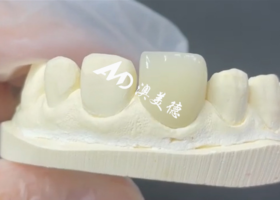 주문 내구성 있고 미적 인 EMAX 플라니어 online manufacture