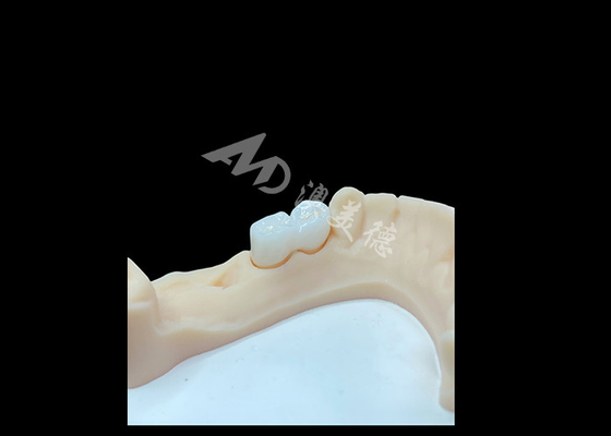 주문 고등급 고체 Zirconia 왕관 의 만족 스러운 치아 복원 online manufacture