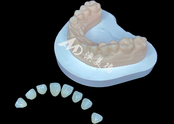 주문 IPS e.max 포네어 뛰어난 미소 변형을 위한 프리미엄 미용 솔루션 online manufacture