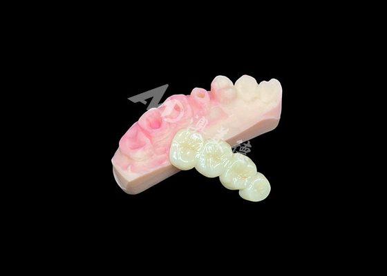 주문 자연스러운 외모의 치과 미용을 위해 우수한 고체 지르코니아 왕관 다리 online manufacture