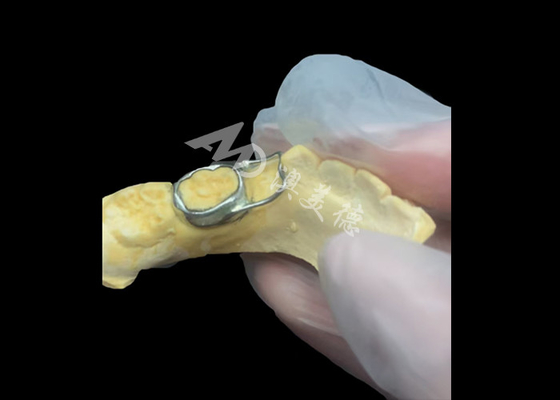 주문 정형 치아 공간 유지기술은 치아의 적절한 발달을 보장하기 위해 치아 틈을 기발하게 보호하는 귀중한 장치입니다. online manufacture