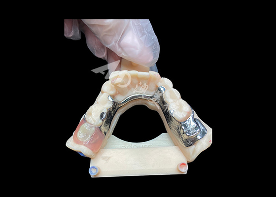 주문 손쉽게 유지보수 할 수 있는 가공 부분 치아 online manufacture