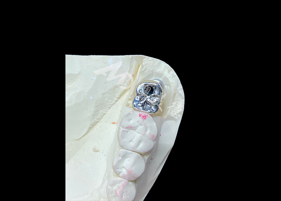 주문 티타늄 부피와 금속에 합성된 포르셀린 PFM 왕관 online manufacture
