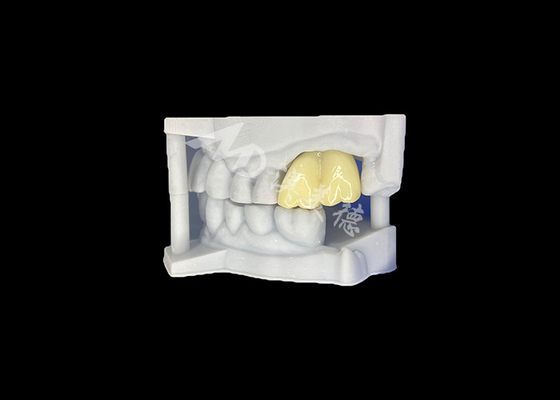 주문 고체 지르코니아 치아 왕관 online manufacture
