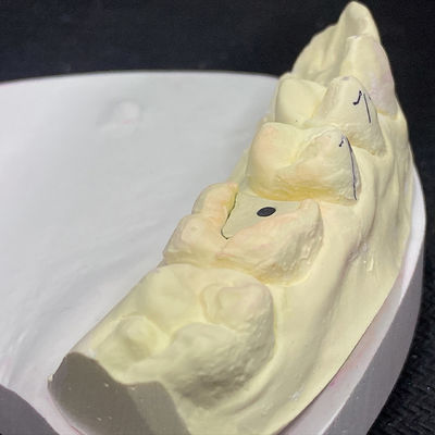 주문 로크 핑크 포스트 코어 기술 으로 복원 을 강화 하십시오 online manufacture