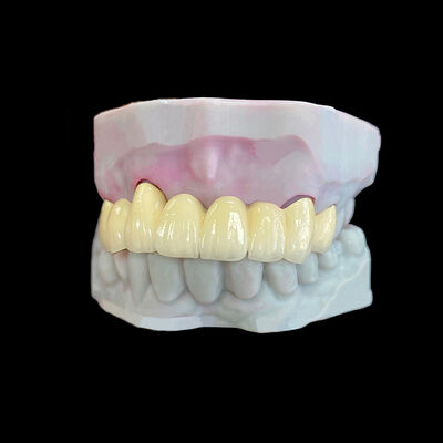 주문 코발트-크롬 프레임워크를 사용한 PFM (Porcelain Fused to Metal) 크라운 online manufacture