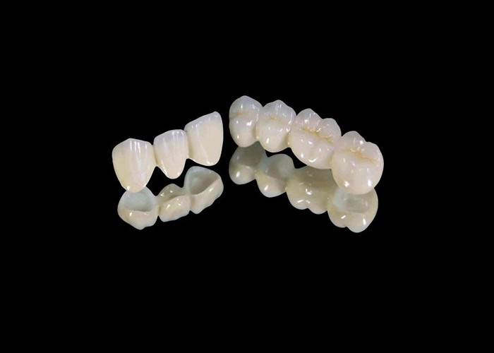 착용 저항성 Zirconia 치아 왕관