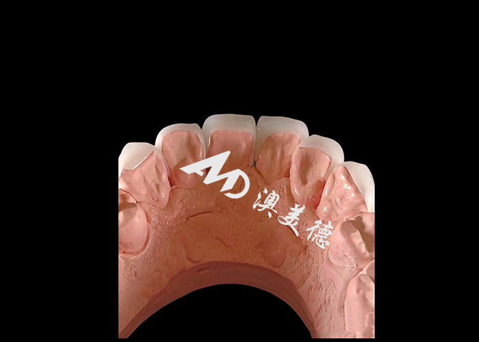 화장품 치과 EMAX 치과 장단 0.3-0.5mm 두께