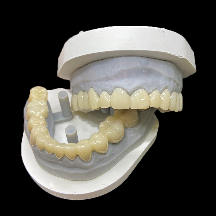 PMMA 임시 수복 CAD/CAM PMMA 크라운 및 브릿지 (임시 치과 케이스)