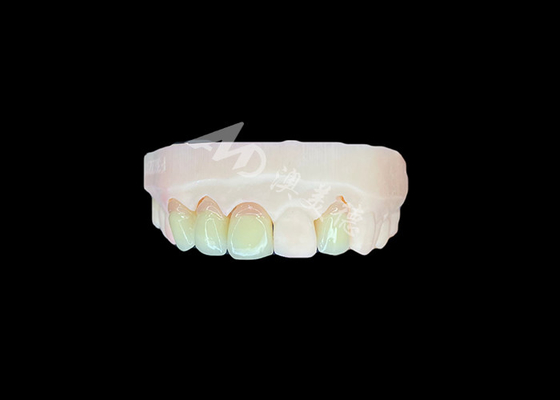 좋은 가격 자연스럽고 편안한 적합성 Zirconia 포르셀라인 왕관 중국 치과 연구실 사용자 정의 가능한 그림자 온라인으로