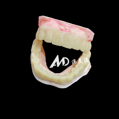 좋은 가격 Lightweight PMMA Temporary Bridges with Hollow Design for Implant Restorations 온라인으로