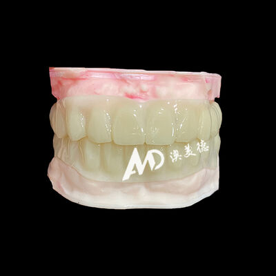 좋은 가격 PMMA Hollow Temporary Bridges for Implant Provisional Cases 온라인으로