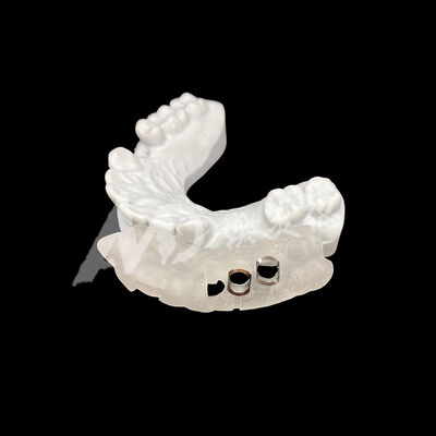 좋은 가격 CAD/CAM 밀링 기술을 사용하여 변색에 대한 저항력이 뛰어나고 정밀하게 맞는 3D 프린팅 수술용 임플란트 가이드 온라인으로