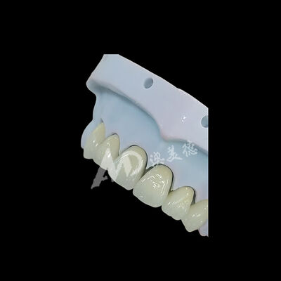 좋은 가격 전체 윤곽의 일자리 Zirconia 치아 왕관 온라인
